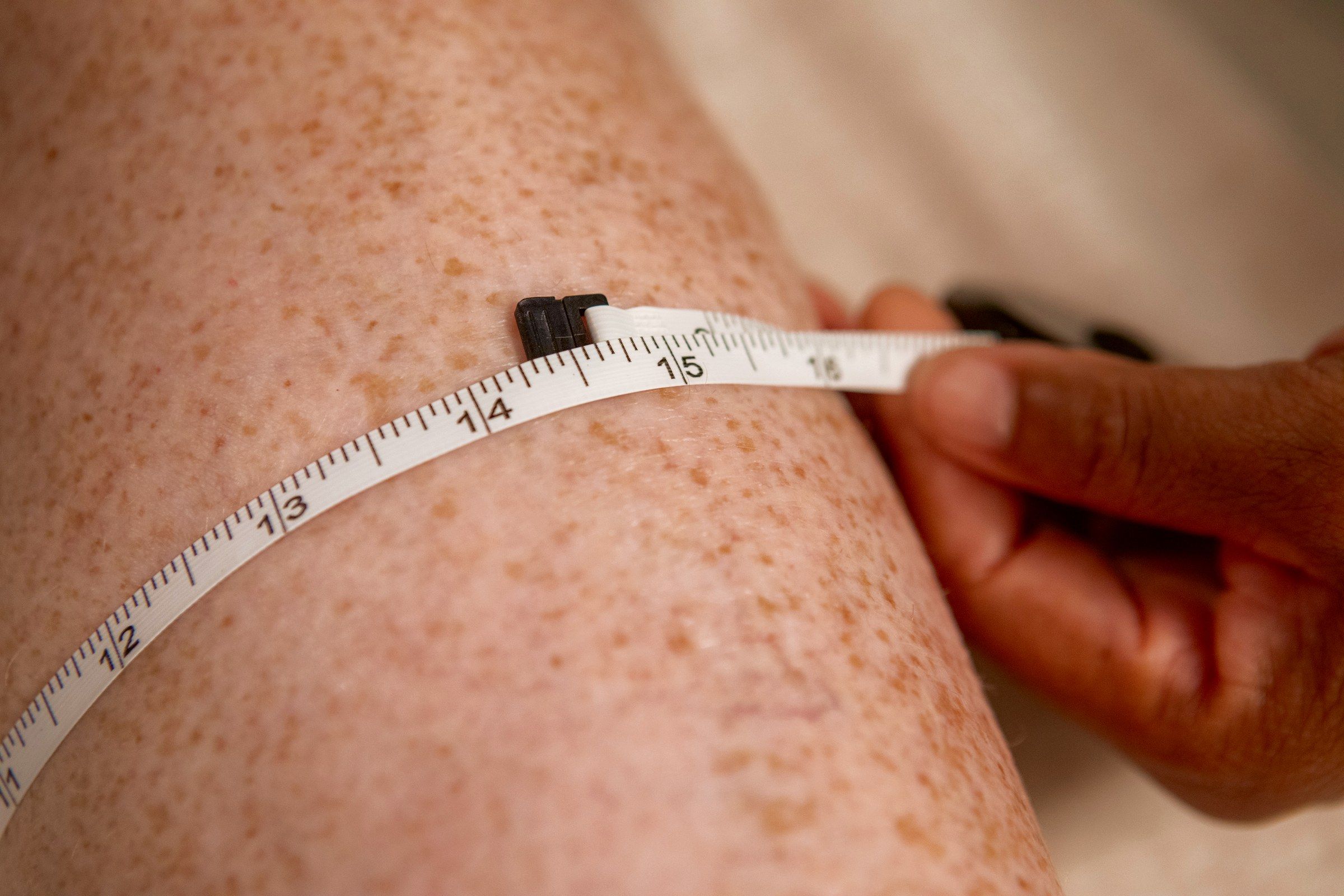 A tape measure around a client's leg, measuring before lymphatic work